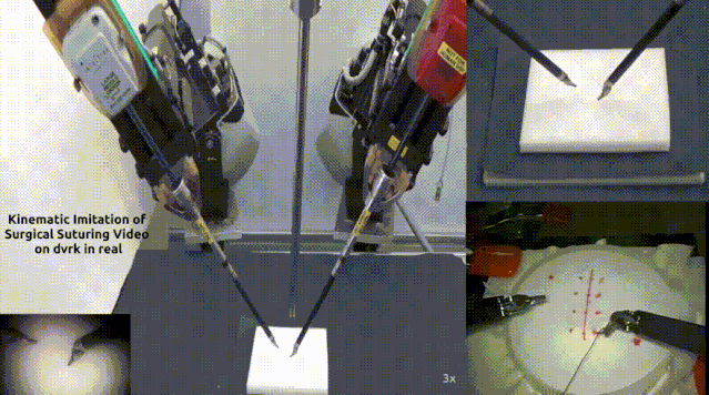 下一次给你缝伤口的，可能是手术机器人