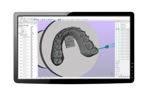 HiperMOS Dental 牙套切割解决方案