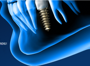 雅客智慧 临床案例